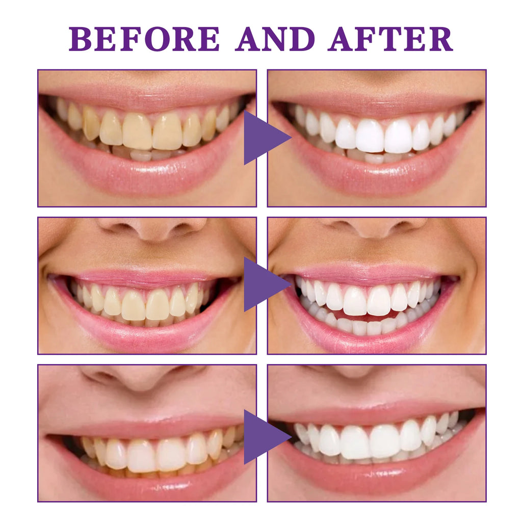 V34 Teeth Whitening Mousse Toothpaste Dental Care